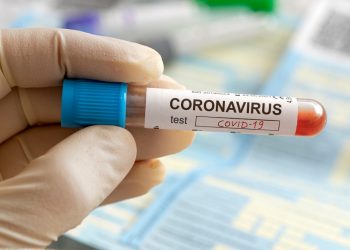 Epidemiološka situacija ALARMANTNA: I ovaj grad u Srbiji ima više zaraženih nego u vrhuncu prvog talasa