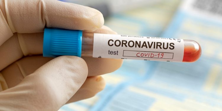 Epidemiološka situacija ALARMANTNA: I ovaj grad u Srbiji ima više zaraženih nego u vrhuncu prvog talasa