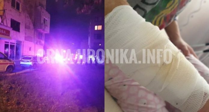 OGLASILA SE DJEVOJKA KOJU JE MIGRANT NOŽEM NAPAO I OTEO TELEFON: “OPORAVLJAM SE, RANA JE VELIČINE 10 CM”