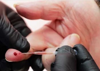 Stručnjaci tvrde da su serološki testovi nepouzdani za utvrđivanje imuniteta