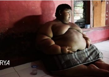 (Video) VIŠE NE IZGLEDA OVAKO: Najdeblji dečak na svetu još prošle godine imao je 193 kg, a sada se bukvalno – PREPOLOVIO!