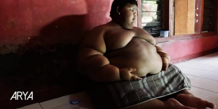 (Video) VIŠE NE IZGLEDA OVAKO: Najdeblji dečak na svetu još prošle godine imao je 193 kg, a sada se bukvalno – PREPOLOVIO!