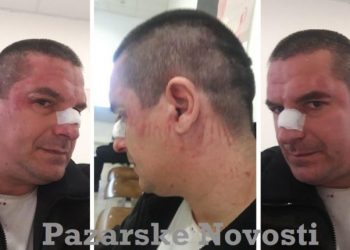 Novopazarskog Građanskog Aktivstu Irfana Ugljanina Napali U Jednom Kafiću