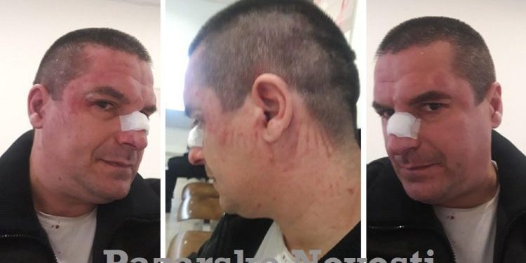Novopazarskog Građanskog Aktivstu Irfana Ugljanina Napali U Jednom Kafiću