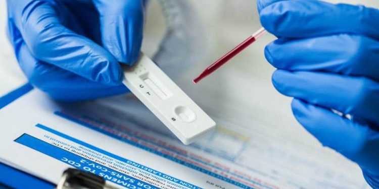 (VIDEO)Testovi na antitijela: Vrijednost rezultata ne govori ništa o zaštiti