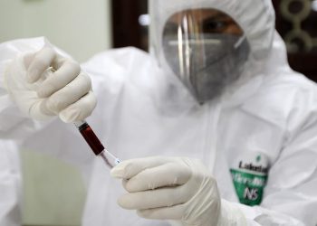 Švedska studija: Krvna grupa sa najvećim rizikom od tromba