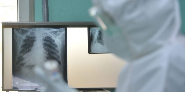 U Srbiji još četvoro umrlo od kovida-19, još 189 novoinficiranih