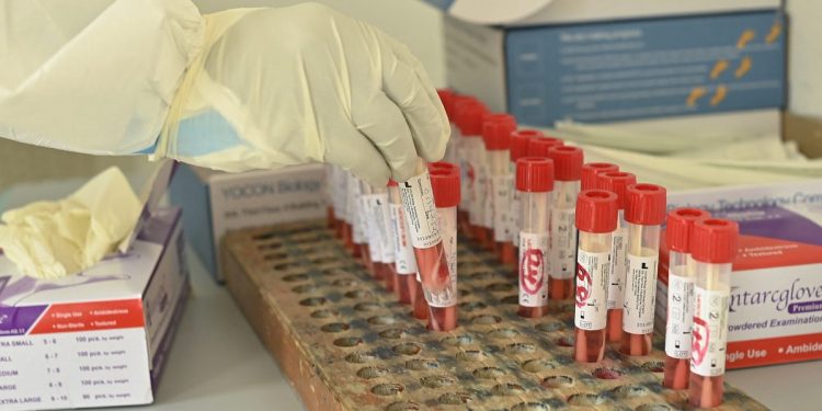 Uvedena NOVA MERA: NEVAKCINISANI će morati da PLAĆAJU TESTIRANJE