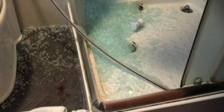 Staklo tuš kabine isjeklo Tutinca: “Vlasnik hotela me nije pozvao ni da pita kako sam”